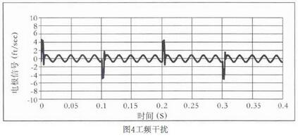 图4工频干扰